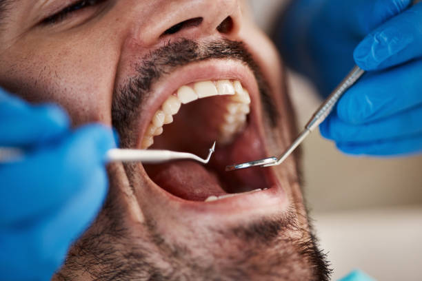 Best Emergency Tooth Extraction in North Kingsville, OH