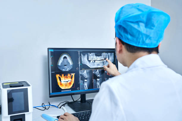 Best Emergency Wisdom Teeth Removal in North Kingsville, OH